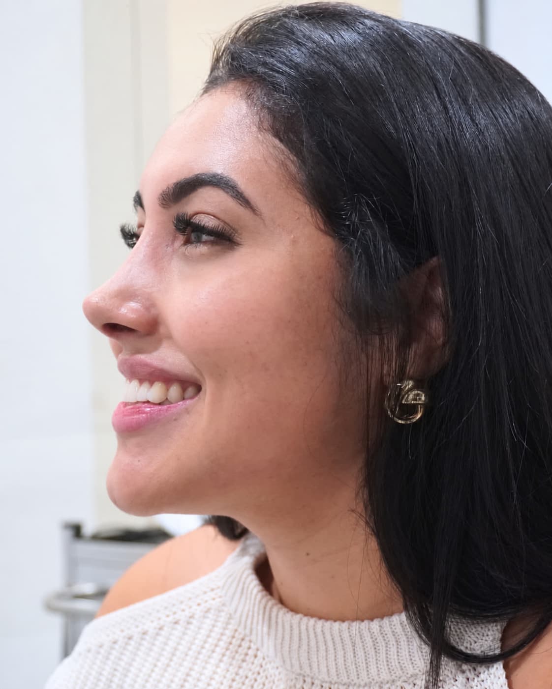 Precio de rinoplastia en Barcelona